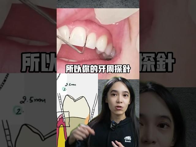 你有牙周病嗎？一個簡單工具就可判斷#牙齦炎#牙周病