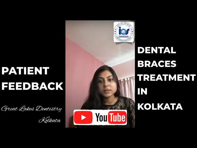 Dental braces before and after | time lapse | Best Braces Dentist in Kolkata | Best Orthodontist