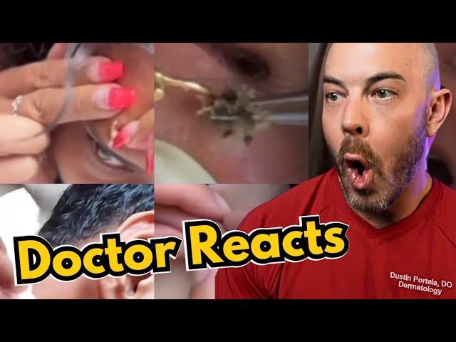 Dermatologist's Reaction to Viral Pimple Popping, Cyst Popping TikToks