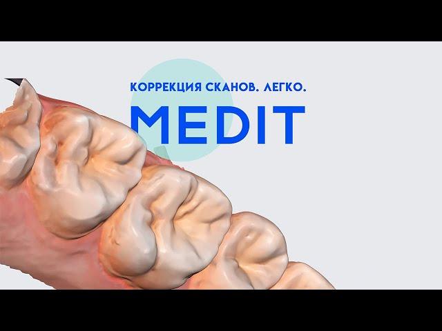 КОРРЕКЦИЯ СКАНОВ. ЛЕГКО. MEDIT | ARTICON