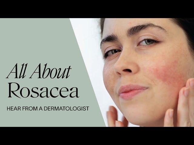 All about Rosacea | According to a Dermatologist