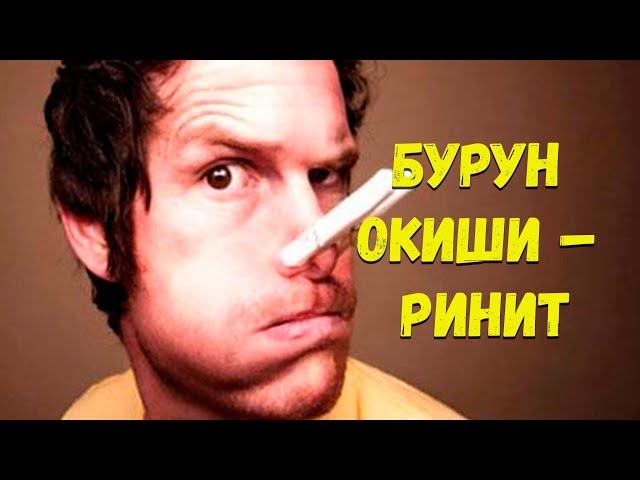 Бурун оқиши – ринит