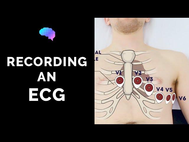 How to record an ECG - OSCE Guide | UKMLA | CPSA | PLAB 2