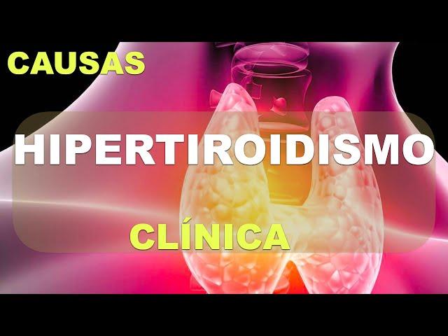 Hipertiroidismo: causas y síntomas (Graves, Adenoma...)