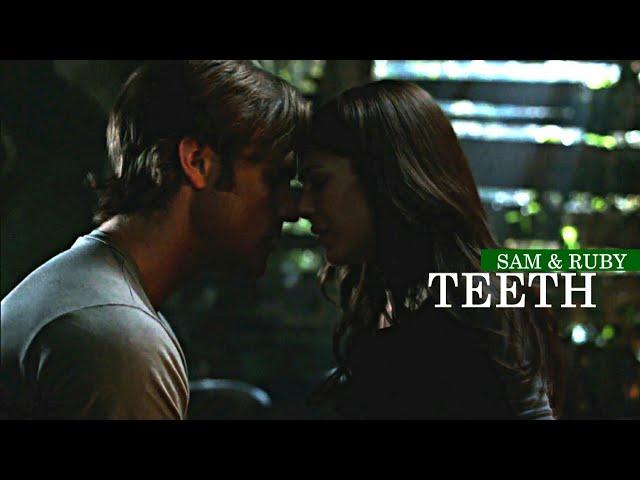 sam & ruby | teeth