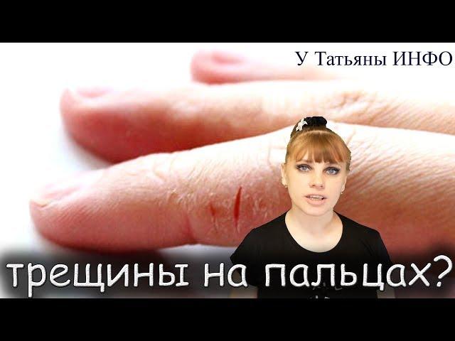 ТРЕЩИНЫ на РУКАХ или НОГАХ и что с ними делать???