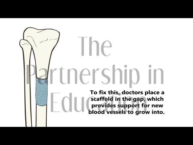 Bone Scaffold Animation | The Partnership in Education