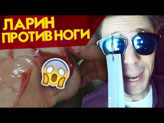 СКАЛЬПЕЛЬ В НОГЕ (ДМТ) РЕАКЦИЯ  ДА НИЛ