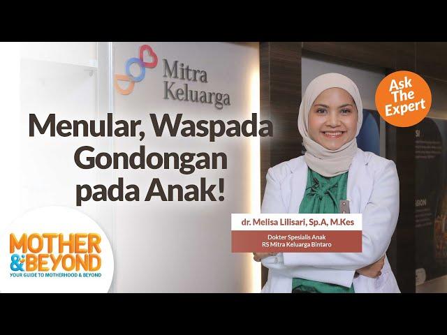 Ask The Expert: Menular, Waspada Gondongan pada Anak