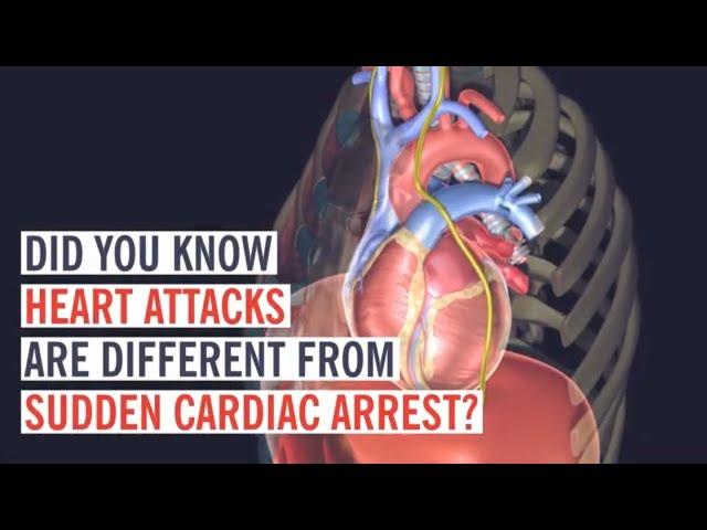 Heart Attack vs. Cardiac Arrest: What’s the Difference?