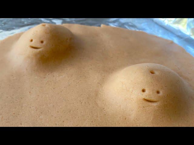 Playdough Surgery - Cyst Pop 