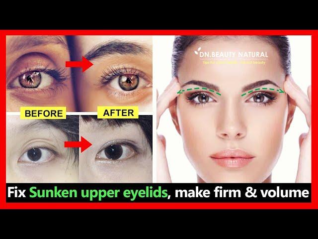 5 exercises Fix Sunken upper eyelids, hollow upper eyelids, Make firm and volume (no filler)