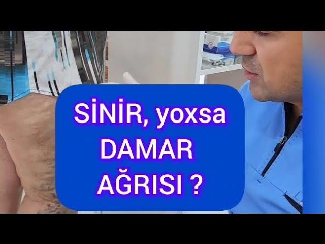 sinir yox damar agrilari ayaqlarda etraflarda şikayetler ayaq hekimi varikoz damar cerrahi fleboloq