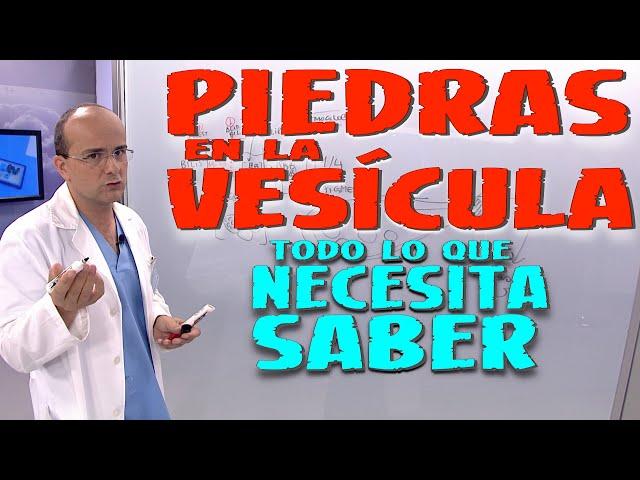 PIEDRAS EN LA VESÍCULA - Todo lo que necesita saber - Enfermedades #19