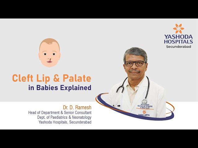 Cleft Lip & Palate in Babies Explained | Yashoda Hospitals Hyderabad