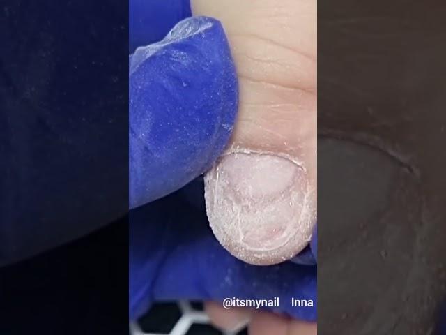 WOW!!! nail injury   #innamaksimova #itsmynail #nailart