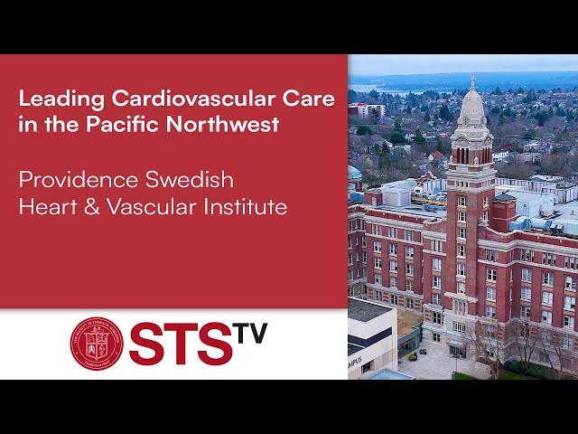 Leading Cardiovascular Care in the Pacific Northwest – Providence Swedish Heart & Vascular Institute