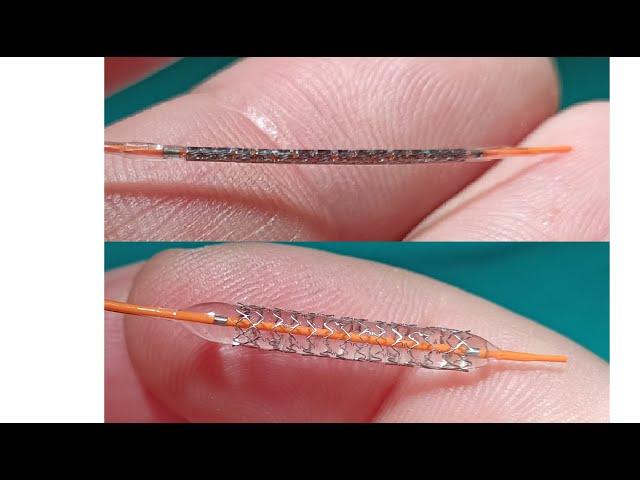 gerçek görüntüler.. stent nedir yakından görelim