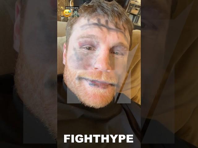 CANELO BATTERED & BRUISED ZOMBIE NINJA; LETS DAUGHTER PAINT HIS FACE FOR HALLOWEEN 2023 OUTFIT