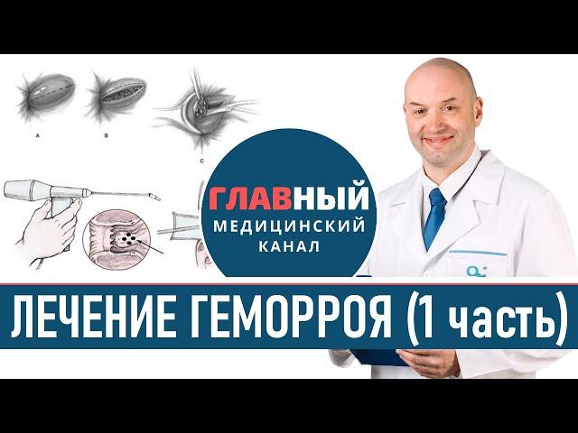 Лечение геморроя (1). Как и чем лечить наружный геморрой. Таблетки, мазь и свечи от геморроя