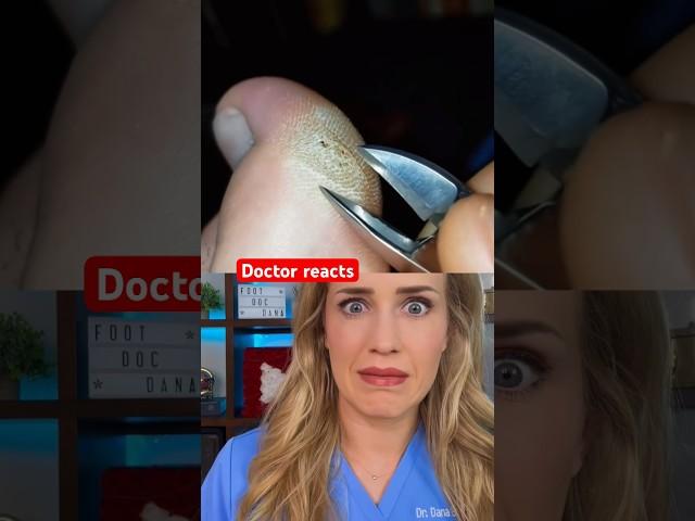 Doctor reacts: foot callus art?