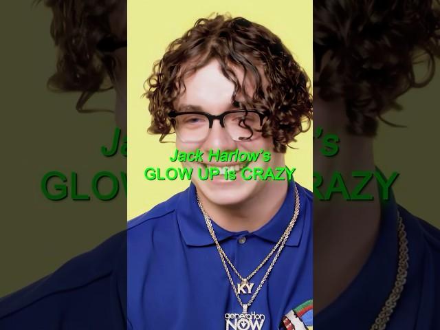 Jack Harlow's Glow Up is CRAZY 