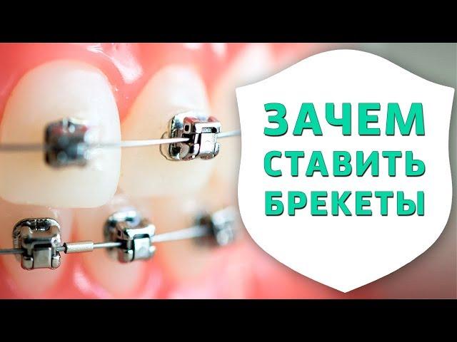 Зачем ставить брекеты? | Опрос на улицах Новосибирска | Дентал ТВ