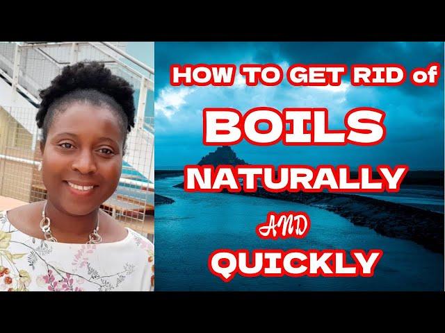 How To Get Rid Of A Boil Naturally And Quickly