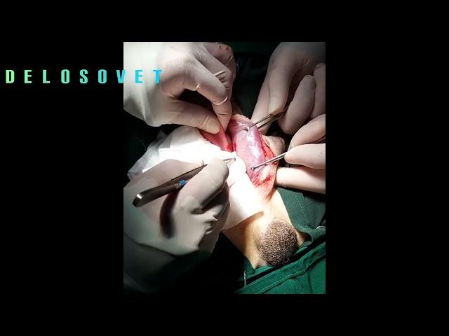Quick Perineal Hernia Surgery