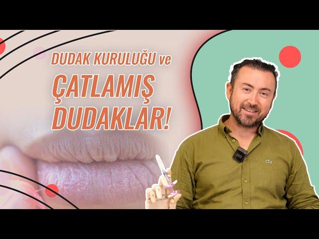 Dudak Kuruluğu, Çatlamış Dudaklar: Dermatolog Önerileri  Dry,Chapped Lips: Dermatologist Suggestions