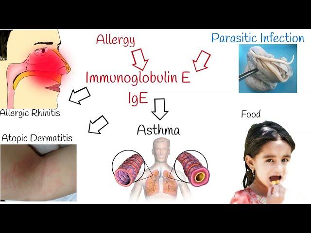 Blood Test: Immunoglobulin E (IgE) -  what does a high immunoglobulin e level mean