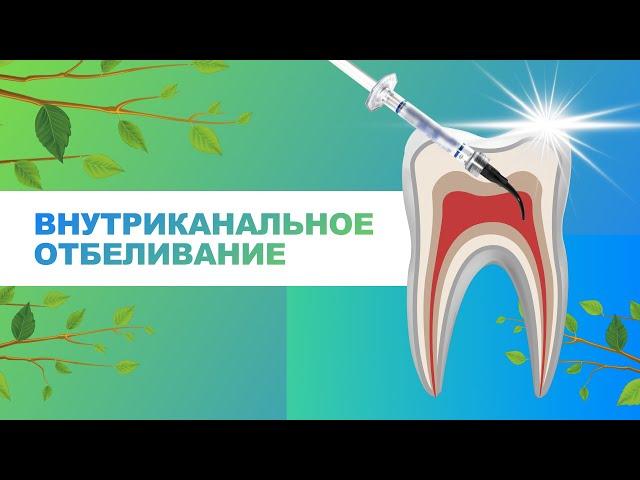 ▶️​ Внутриканальное отбеливание