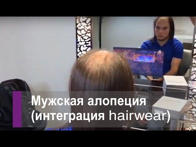 Мужская алопеция - больше не проблема! Наращивание системы интеграции hairwear