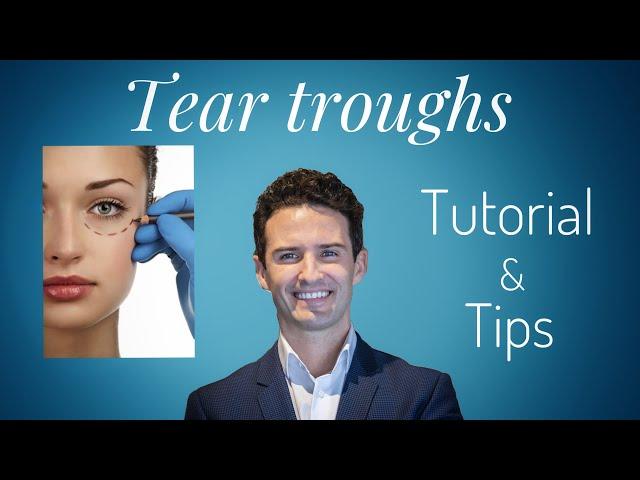 Dermal Fillers: Tear Troughs! Truths & Tips