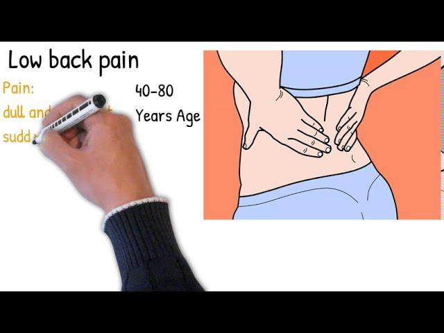 Low back pain - Symptoms, causes, treatment and prognosis