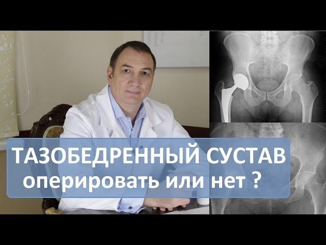 Операция тазобедренного сустава: делать или нет. Эндопротезирование.