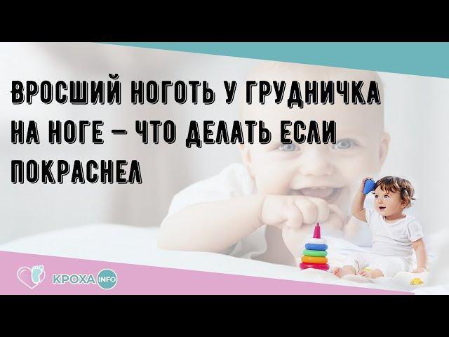 Вросший ноготь у грудничка на ноге — что делать если покраснел