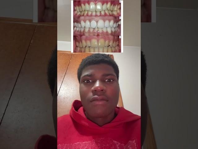 #funny #freestylerap #rap #ishowspeed #rapper #duet #amp #freestylerapper #speed #drill