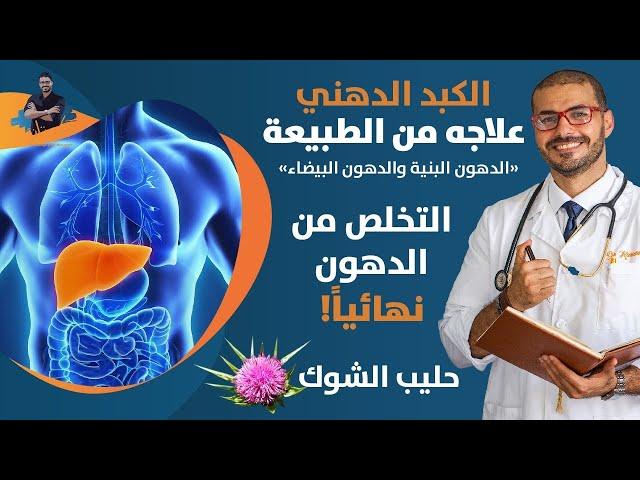 علاج الكبد الدهني بدون ادوية _ الدهون البنية والدهون البيضاء_ حليب الشوك