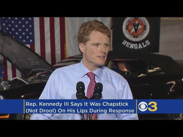 No, That Wasn't Drool On His Lips, Rep. Joe Kennedy Says