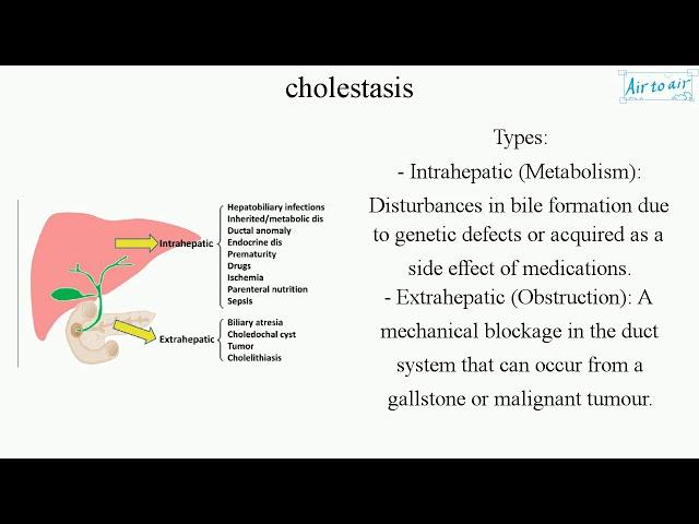 cholestasis