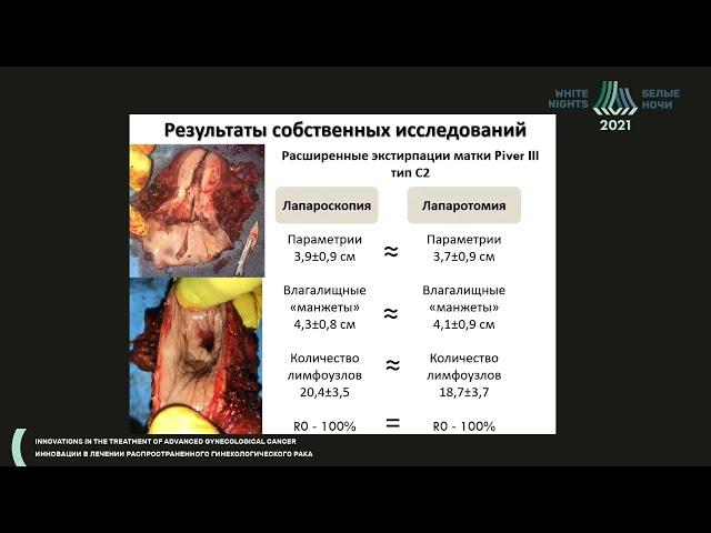 Surgical capabilities in locally advanced cervical cancer (IIA-IIIB) (Dmitry Ovodenko)