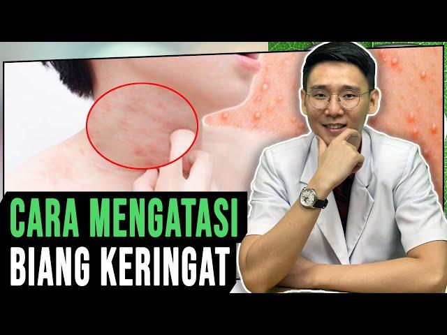 Cara Mengatasi Penyakit Kulit Biang Keringat