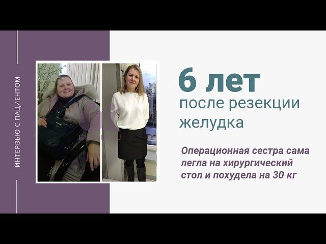 6 лет после резекции желудка для похудения