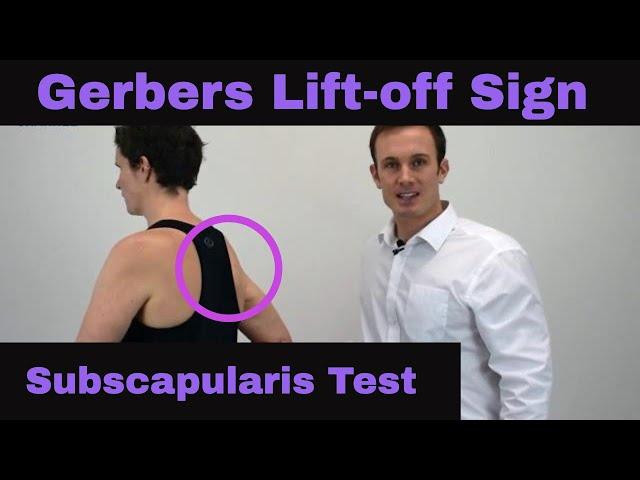 Gerber's lift-off sign of the shoulder for rotator cuff tear