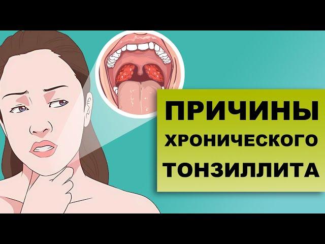 ПРИЧИНЫ ХРОНИЧЕСКОГО ТОНЗИЛЛИТА