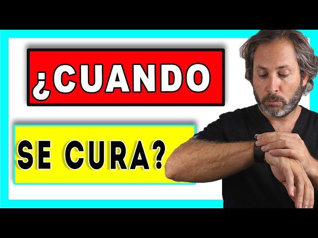 ¿Cuánto tiempo⏳tarda en 𝗖𝗜𝗖𝗔𝗧𝗥𝗜𝗭𝗔𝗥 una EXTRACCION MUELA? Tiempo de  RECUPERACION 𝙈𝙐𝙀𝙇𝘼 𝘿𝙀𝙇 𝙅𝙐𝙄𝘾𝙄𝙊 