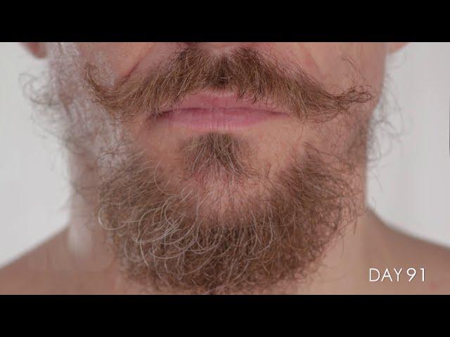 Facial Hair growing for 100 Days in Time-Lapse