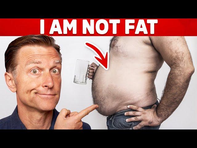 Huge Belly but NOT Fat? – Dr.Berg On Cirrhosis & Ascites