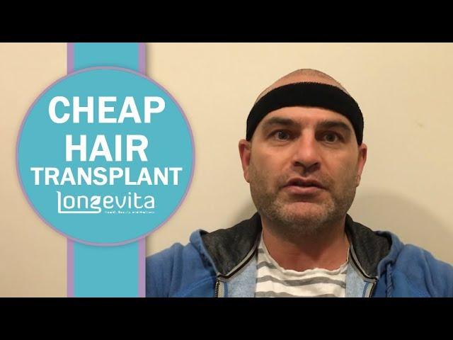 Cheap Hair Transplant in Turkey | Longevita